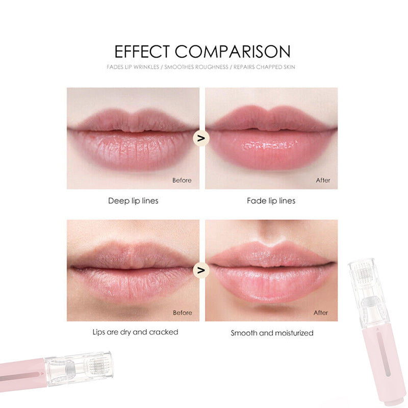 3-in-1 Lip Renewal Roller, Needle Roller for Plumper Lips, Enhanced Care, & Serum Application - CyberLLC